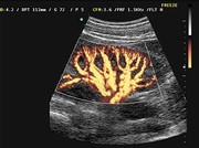 organs of the urogenital tract (kidneys or bladder) can be quickly and easily depicted by ultrasound.