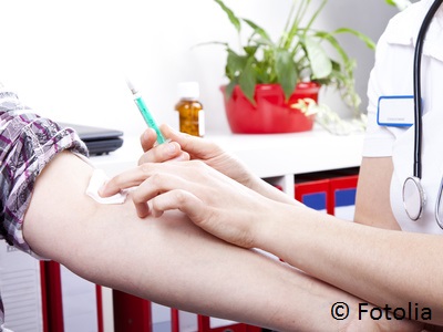 Homocystein ist gefährlich für Herz, Kreislauf und Gehirn