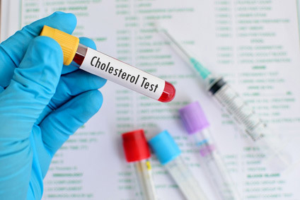 Labor Cholesterol c jarun011 fotolia 96477602 Gesundheitscheck Vorsorgeuntersuchung Diagnoseklinik