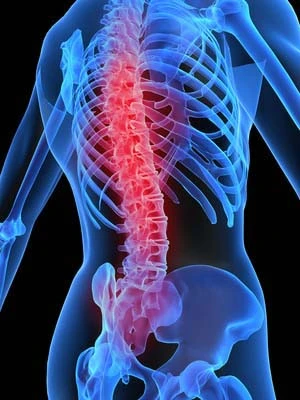 Rueckenschmerz Wirbelsaeule Gesundheitscheck Vorsorgeuntersuchung Diagnoseklinik