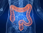 Darmkrebs frueh erkennen Gesundheitscheck Vorsorgeuntersuchung Diagnoseklinik