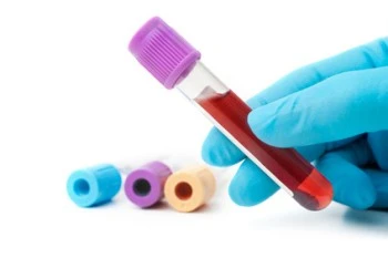 Eisenmangel: Neue Ferritin-Zielwerte verbessern die Diagnose