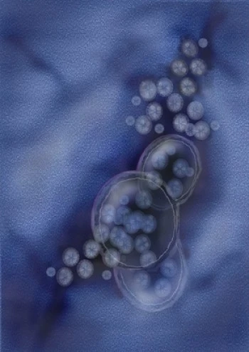 Darmentzündungen durch Norovirus verursachen schwere Durchfälle 