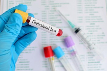 Cholesterinsenker: Neue Wirkstoffe helfen bei extremen Werten
